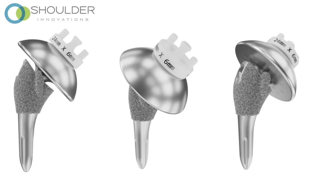Total shoulder implants from Shoulder Innovations